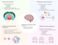 Spatial Transcriptomics in Alzheimer's Disease: Technologies, Challenges and Discoveries