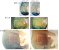 Inactivation of Histone Chaperone HIRA Unmasks a Link between Normal Embryonic Development of Melanoblasts and Maintenance of Adult Melanocyte Stem Cells