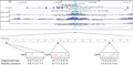 A Proof-of-Concept Study for the Pathogenetic Role of Enhancer Hypomethylation of MYBPHL in Multiple Myeloma